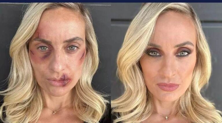 image Ελεονώρα Μελέτη: Η συγκλονιστική ανάρτησή της για την κακοποίηση – «Μήπως έχεις υπάρξει και εσύ θύμα;»