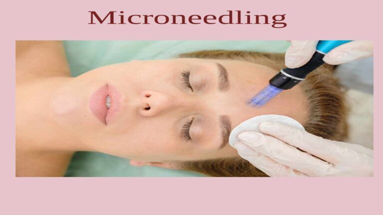 image Skin Care Lab:  Microneedling (μέθοδος μεσοθεραπείας)