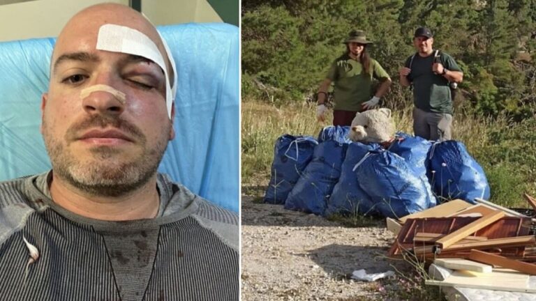 image Πάρνηθα: Φωτογραφίες σοκ με τραύματα των εθελοντών – Με τρεις μαχαιριές στην πλάτη και κάταγμα στη μύτη ο ένας