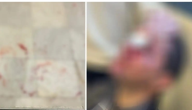 image Νομική Σχολή Αθηνών: Κουκουλοφόροι εισέβαλαν σε εκδήλωση και χτύπησαν φοιτητές – Στο νοσοκομείο ένας άνθρωπος