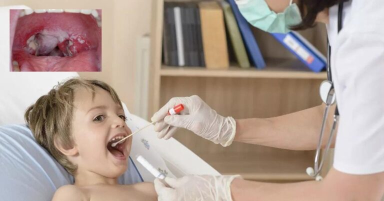 image O Ιατρικός Σύλλογος Λήμνου, οδηγίες για τον Στρεπτόκοκο.